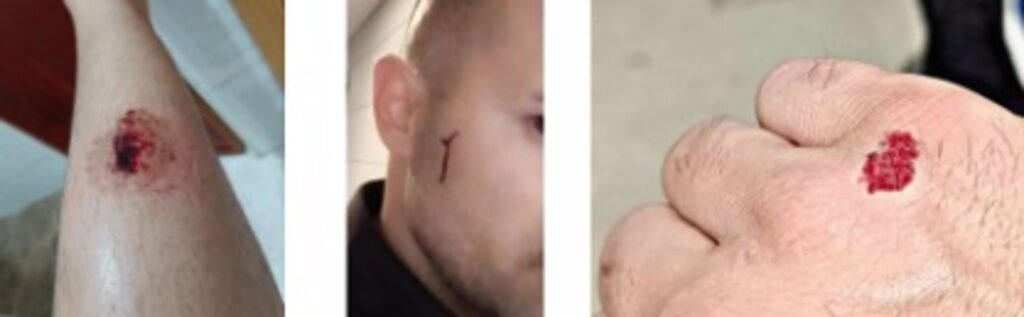 Un hombre agrede a varios policías al fallarles la táser por un problema electrónico