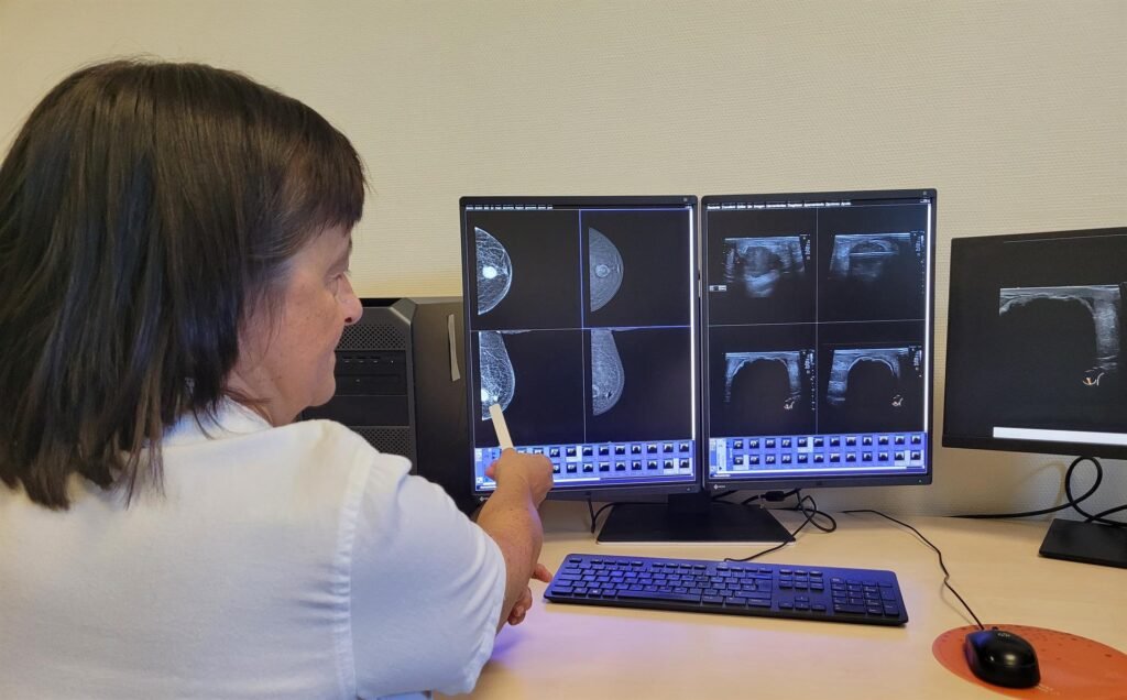 El Infanta Leonor incorpora la crioablación para tratar el cáncer de mama