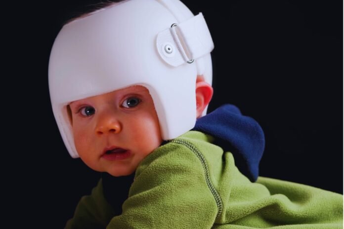 ortesis craneal - IP (1)