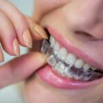 Tecnología y salud dental para mejorar la estética de la sonrisa