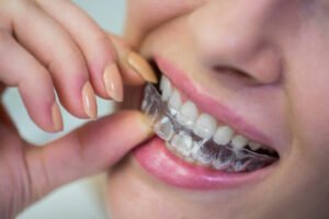 Tecnología y salud dental para mejorar la estética de la sonrisa